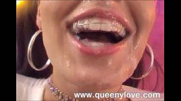 You Like The Schoolgirl Look, Braces And Facials Then Take A Look